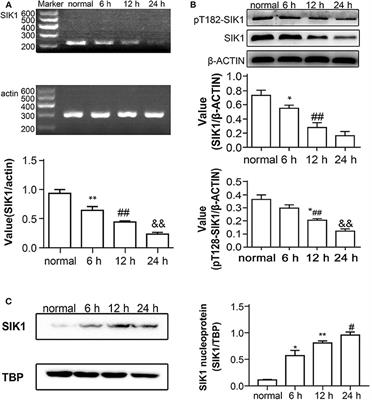 SIK1 Regulates CRTC2-Mediated Gluconeogenesis Signaling Pathway in Human and Mouse Liver Cells